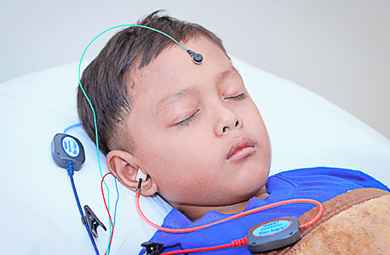 B.E.R.A Tests and Levels of Hearing Loss